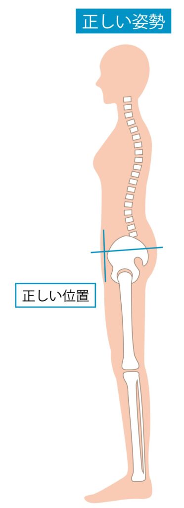 膝痛を軽減した骨盤の正しい位置